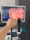 OLYMPUS CF-H180AL Colonoscope