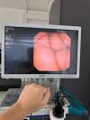 OLYMPUS URF-V Ureteroscope