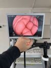 FUJINON EG-600WR Gastroscope
