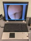 JEDMED Endoscopy System  w/ Light Source, Camera, Endoscopy Cable & HP EliteBook 8730w Workstation