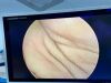 OLYMPUS WA2T412A HD Cystoscope 4 mm, 12° OES Elite - New Open Box Cystoscope