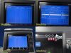 GE HEALTHCARE 2018  Mac 5500HD ECG/EKG Machine W/ Interface Cable