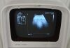 SIUI CTS-7700 Digital Ultrasound System W/ Transducer C3L60B 3.5MHz &amp; Printer - 172491 Imaging System