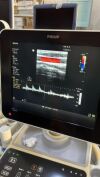 PHILIPS SPARQ ULTRASOUND MACHINE
