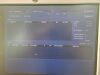 GE Voluson S6 Ultrasound System (Year: 2014)
