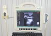 BARD SiteRite 6 Ultrasound System 9770066 W/ Transducer 9770001 and Cart - 172700 Rite 6 System