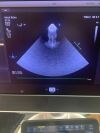 PHILIPS X7-2T Ultrasound Transducer