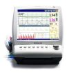EDAN F9 Express Fetal Monitor