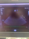 PHILIPS S8-3 Ultrasound Transducer