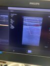 PHILIPS L12-3 Ultrasound Transducer
