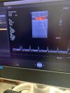 PHILIPS L12-3 Ultrasound Transducer
