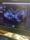 PHILIPS C10-4EC Ultrasound Transducer