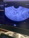 PHILIPS C10-4EC Ultrasound Transducer