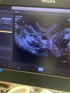 PHILIPS C10-4EC Ultrasound Transducer