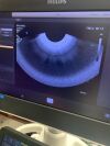 PHILIPS C10-4EC Ultrasound Transducer