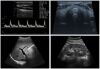 SONOSCAPE E1V VET Vet. Ultrasound