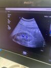 PHILIPS C9-2 Ultrasound Transducer