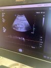 PHILIPS C9-2 Ultrasound Transducer