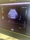 PHILIPS C9-2 Ultrasound Transducer