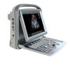 CHISON ECO5 Vet. Ultrasound