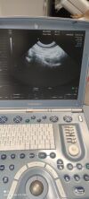 GE E8C-RS Ultrasound Transducer