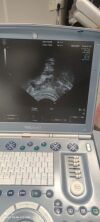 GE E8C-RS Ultrasound Transducer