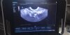 GE MINDRAY DC-N3 Ultrasound - OB / GYN - Vascular