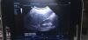 GE MINDRAY DC-N3 Ultrasound - OB / GYN - Vascular