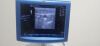 GE Logiq P3 Ultrasound - OB / GYN - Vascular