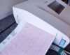WELCH ALLYN CP150 ECG EKG Electrocardiograph Machine 901049 ECG unit