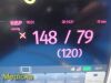 MINDRAY 2012  DPM 7 W/ 115-010744-00 MPM Module & Leads ~Patient Monitor