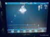 GE Vivid i Ultrasound - Cardiac