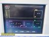 LARSEN & TOUBRO Limited Stellar 404 T Vital Sign Patient Monitor