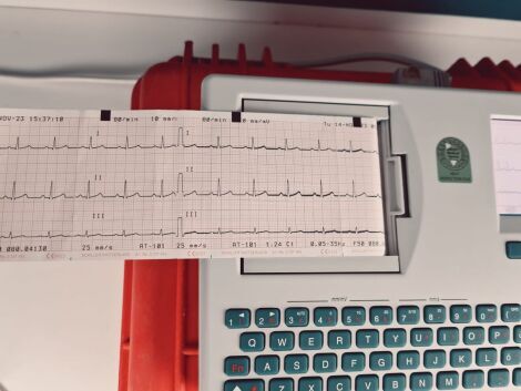 SCHILLER AT 101 ECG unit