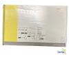 OVESCO 200.11 Ovesco OTSC Anchor 220tt 2200mm 9mm 2-2.5mm max 2.4mm REF 200.11 EXPIRED