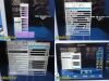 INVIVO 2012 Philips  Expression MRI DCU 865214 Patient Monitor