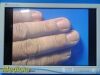 STRYKER 2013  Endoscopy Vision Elect 26" HDTV Monitor