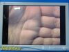 STRYKER 2013  Endoscopy Vision Elect 26" HDTV Monitor