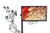 CARL ZEISS OPMI Colposcope