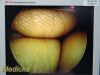 SMITH & NEPHEW 3626 DYONICS Video
