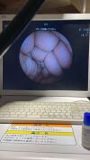 FUJINON EG-530NP Gastroscope