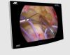 NDS RADIANCE® ULTRA 4K 3D 32” Display Monitor