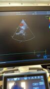 GE 6VTD Ultrasound Transducer