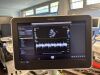 PHILIPS C5-1 Ultrasound Transducer