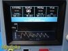 PHILIPS 2014  Novametrix Model: NM3 Respiratory Profile Monitor
