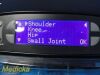 2017 Medical Vision Smith & Nephew Double Pump RF Arthroscopic FMS Console