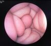 FUJI EG-200FP Endoscope