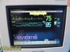 PHILIPS MP5 M8105A (865024) Multiparameter Monitor