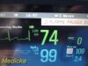 PHILIPS MP5 M8105A (865024) Multiparameter Monitor