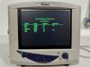 SMITH MEDICAL 9200 2013-02 Monitor